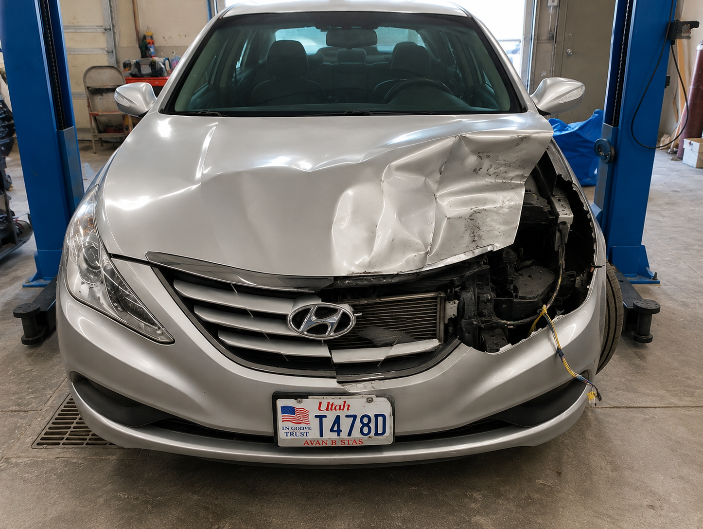 Hyundai before